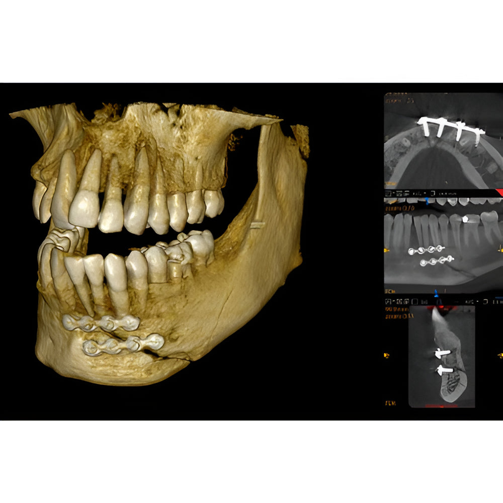 Carestream CS9600 Pan + CBCT (16x10 FOV)