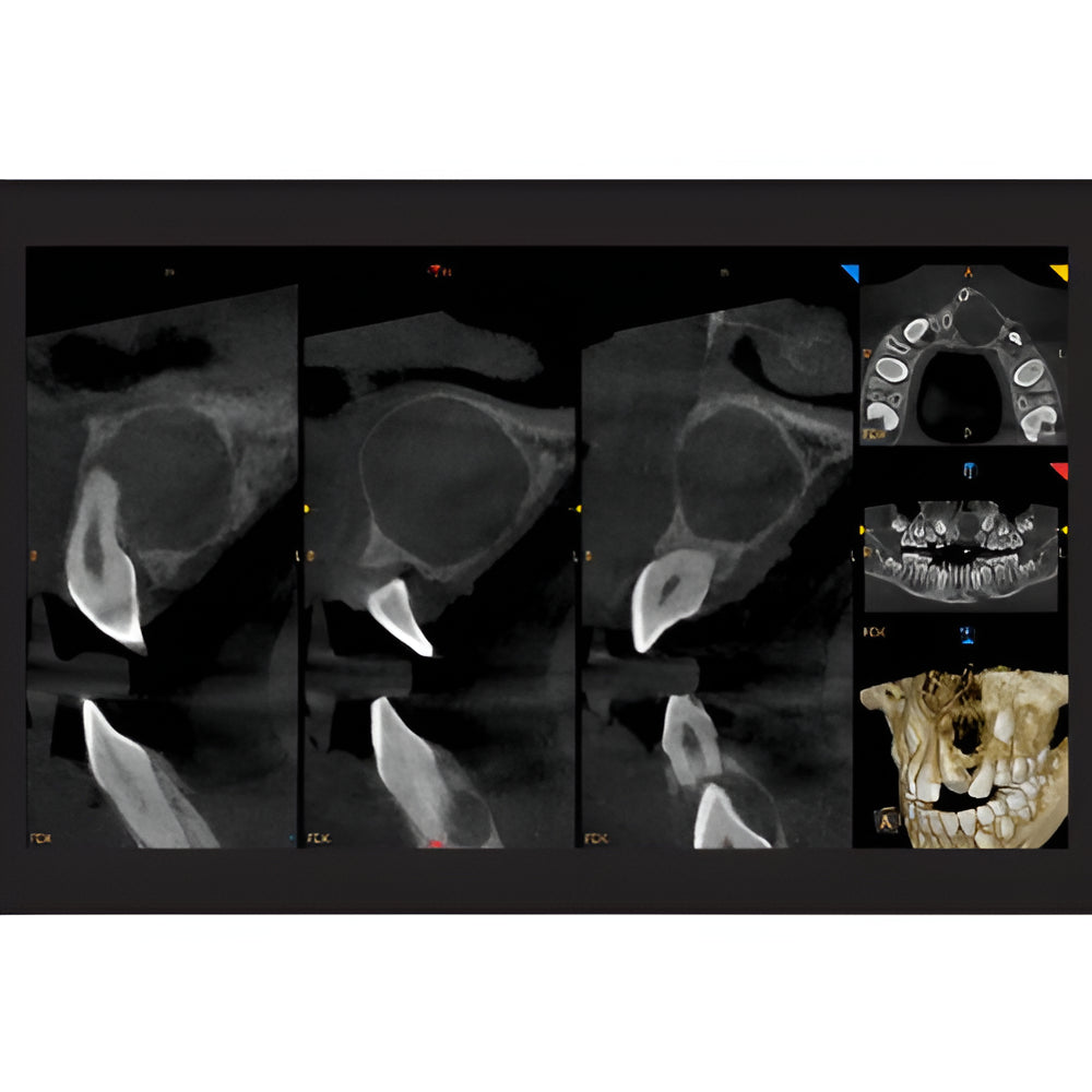 Carestream CS9600 Pan + CBCT (16x10 FOV)