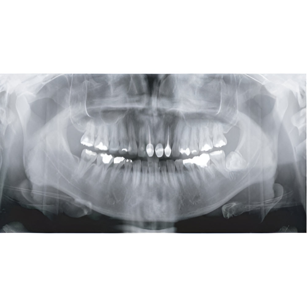 Genoray Papaya 3D Pan + CBCT (14x14 FOV)