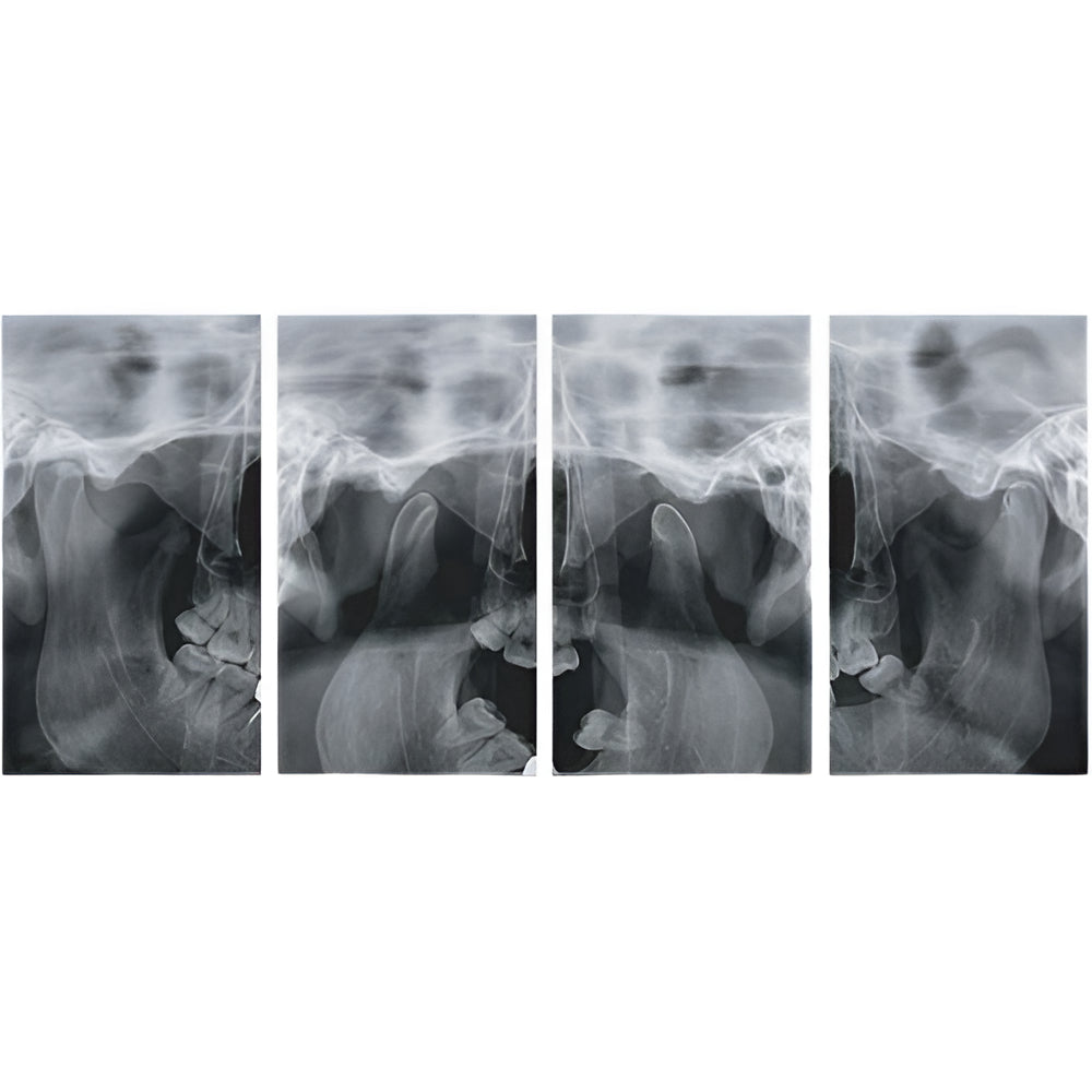 Genoray Papaya 3D Pan + CBCT (14x14 FOV)