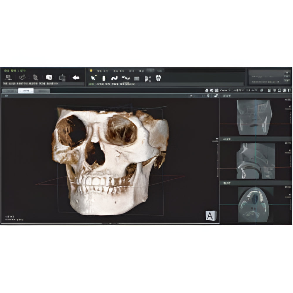 Genoray Papaya 3D Pan + CBCT (14x14 FOV)