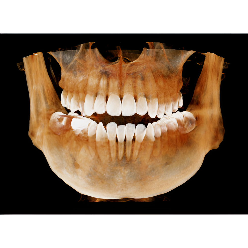 HDX Will Dentri Pan + CBCT
