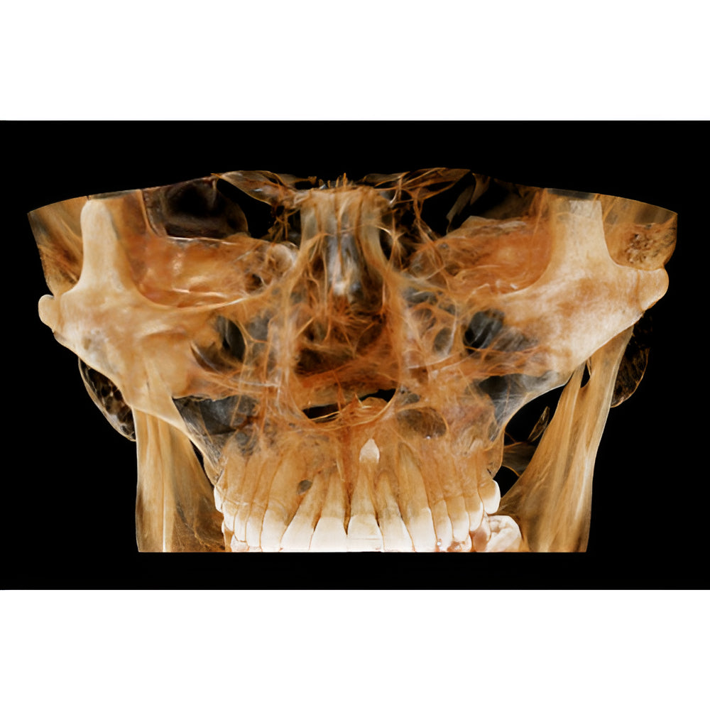 HDX Will Dentri Pan + CBCT