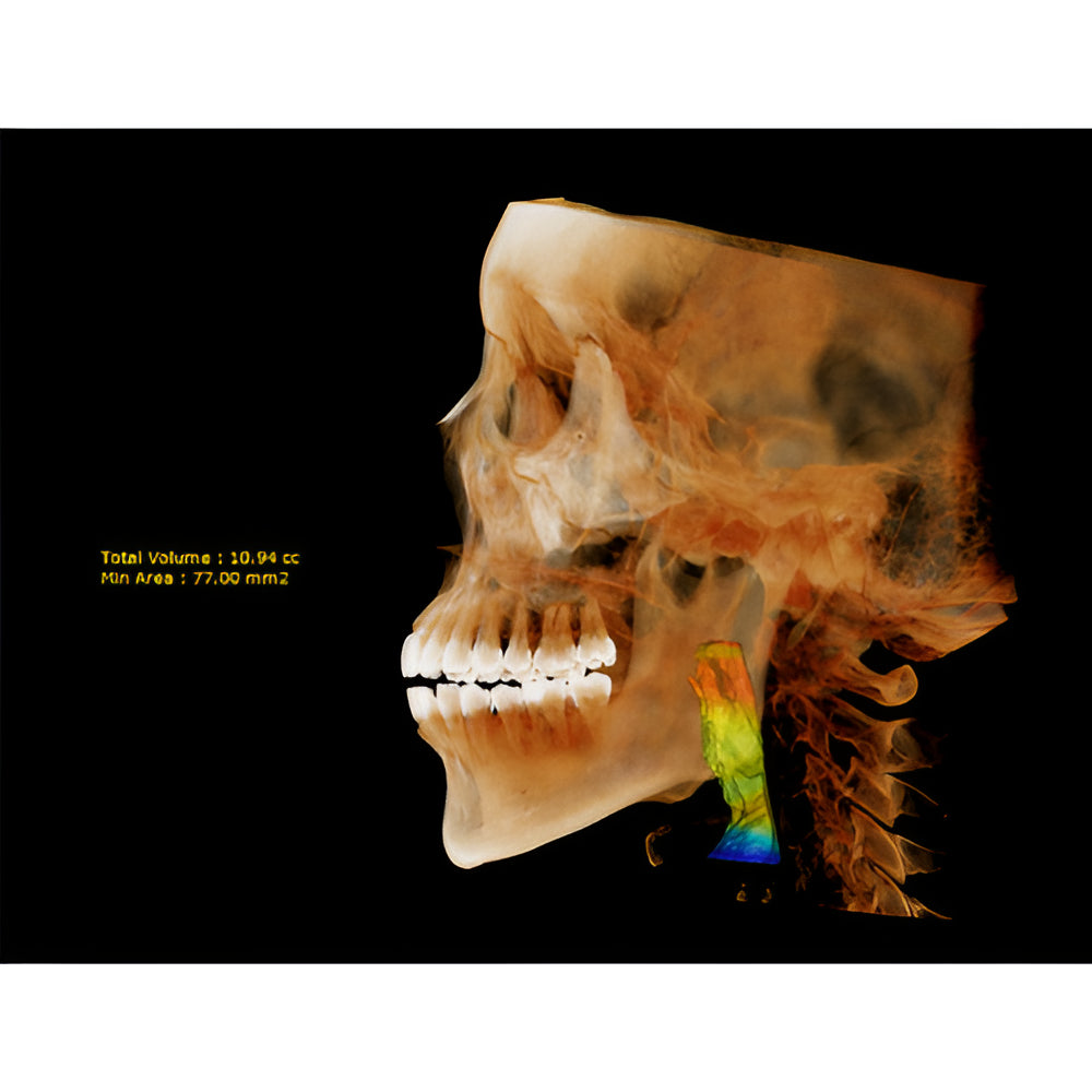 HDX Will Dentri Pan + CBCT