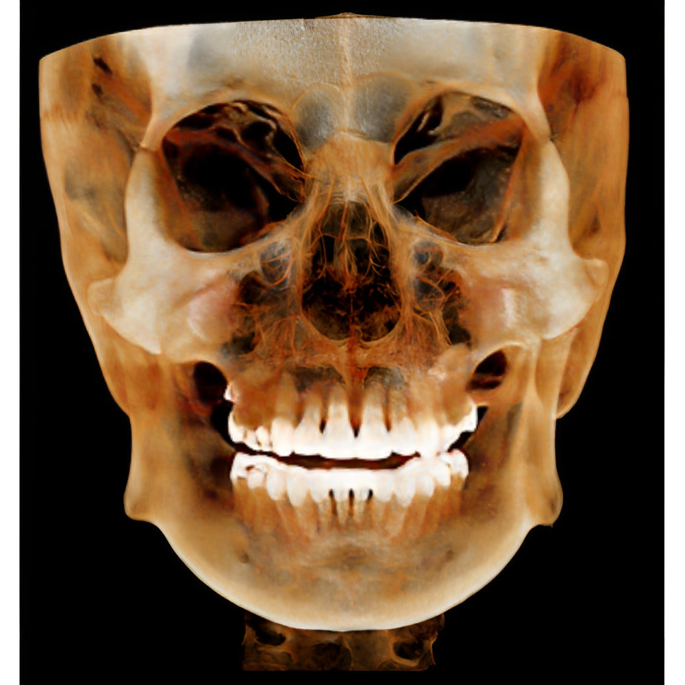 HDX Will Dentri Pan + CBCT