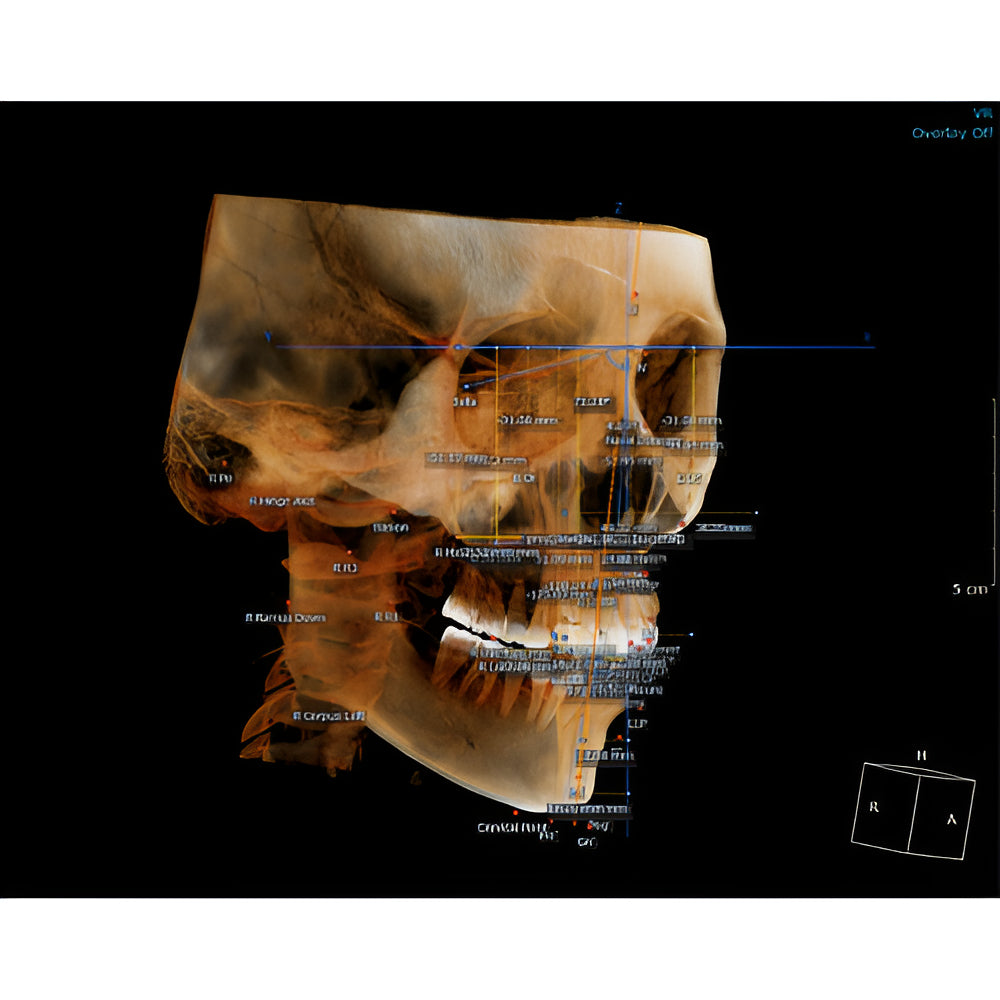 HDX Will Dentri C Max 2D+3D+CBCT Pan Ceph FOV 18x16.5 with PC, Software, Warranty