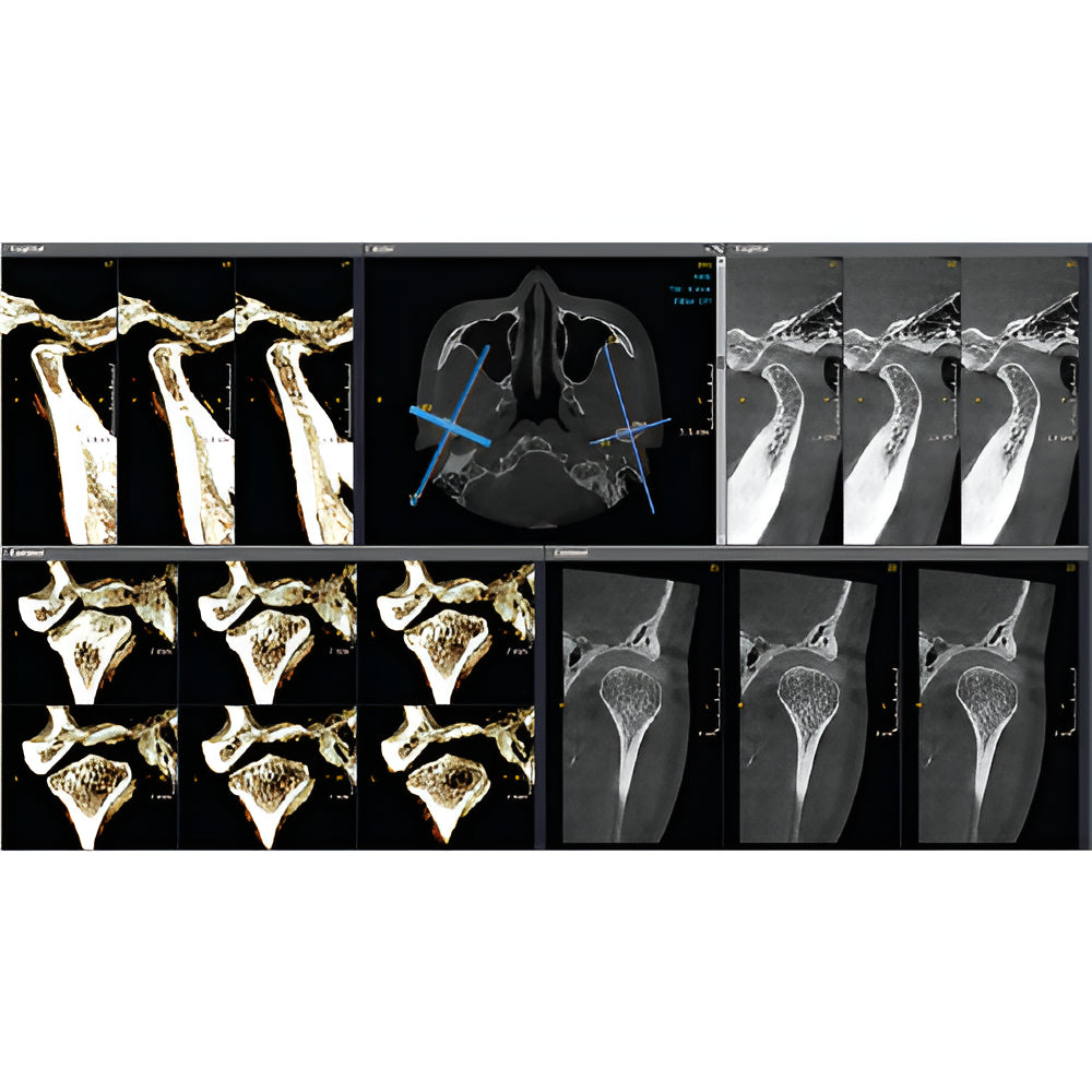 HDX Will Dentri Pan + CBCT