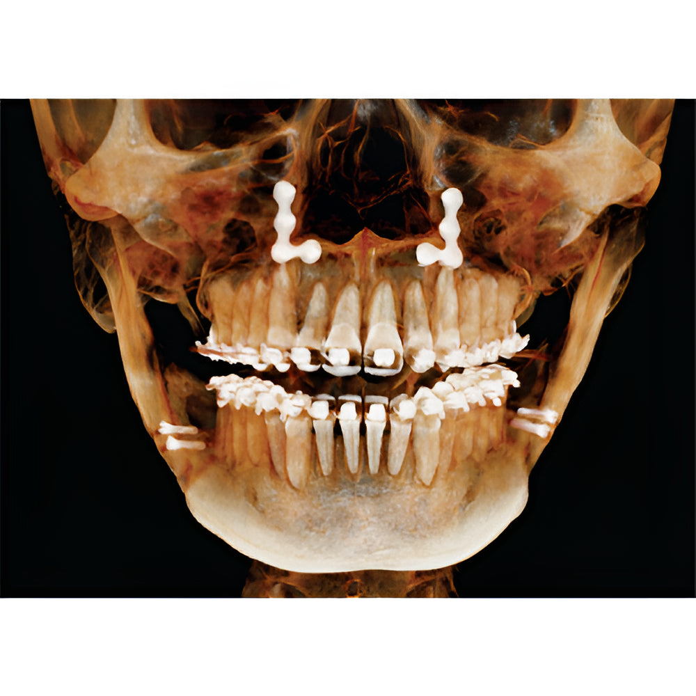 HDX Will Dentri Pan + CBCT