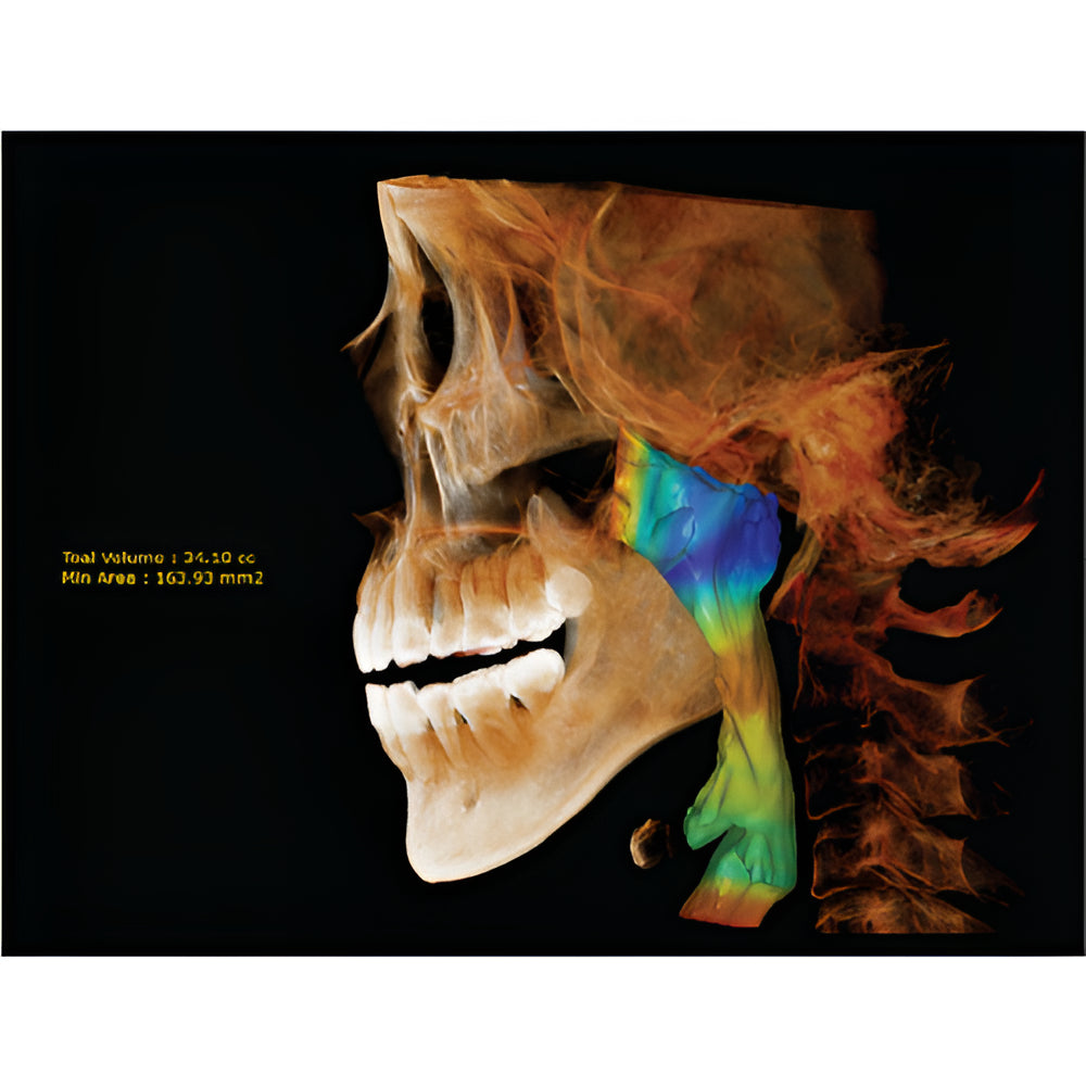 HDX Will Dentri Pan + CBCT