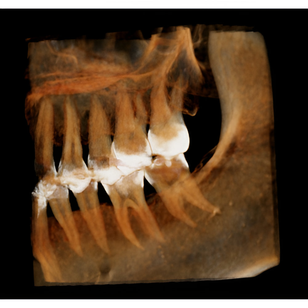 HDX Will Dentri Pan + CBCT