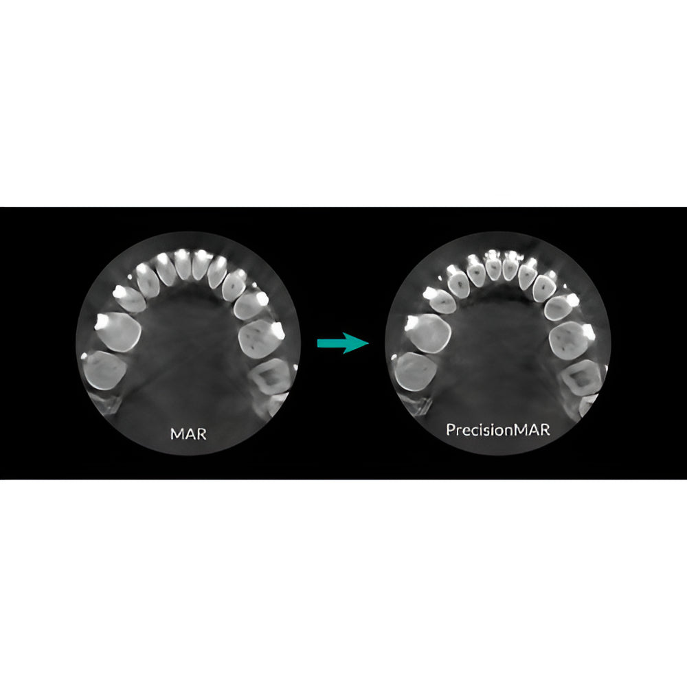 HDX Will Dentri Pan + CBCT