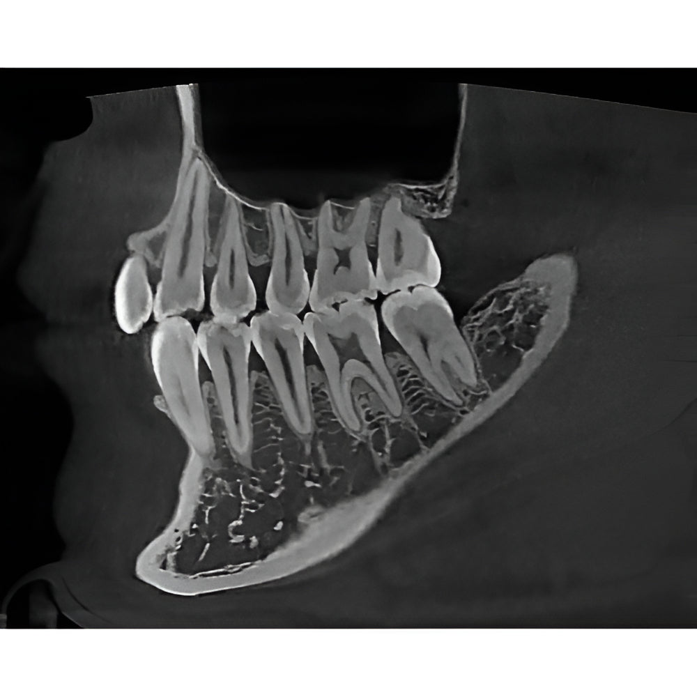 HDX Will Dentri Pan + CBCT
