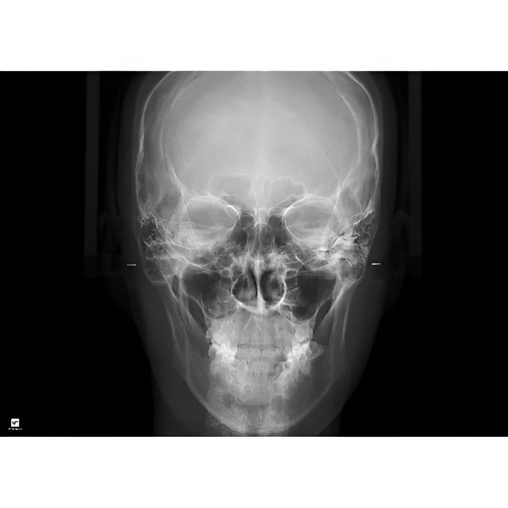 HDX Will Dentri Pan + CBCT