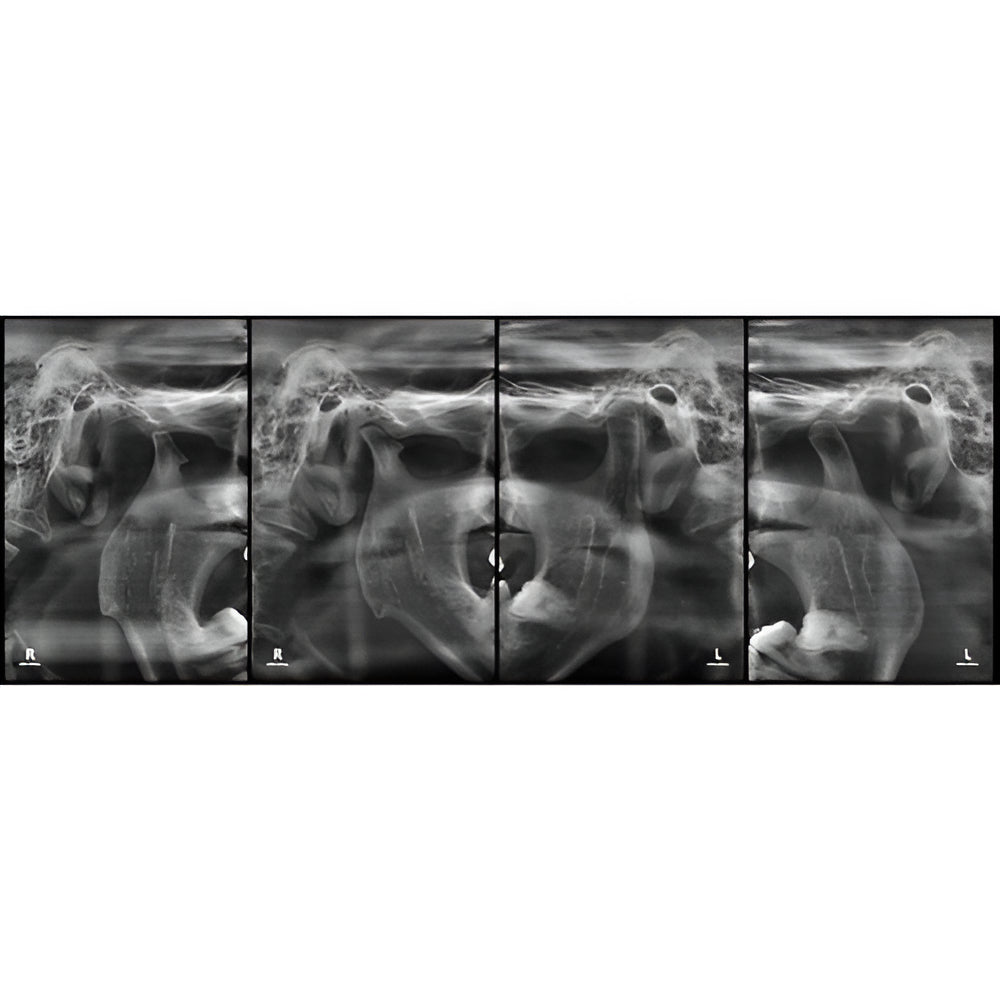 HDX Will Dentri Pan + CBCT