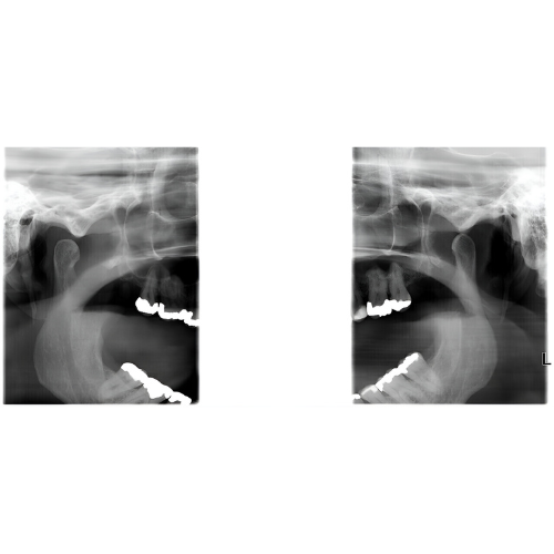 Instrumentarium OC300 Pan + Ceph + CBCT (6x8 FOV)