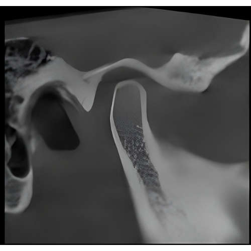 Instrumentarium OP300 Pan + CBCT