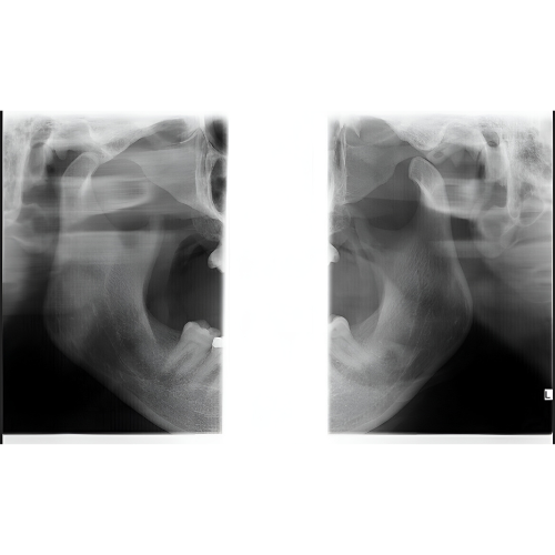 Instrumentarium OP300 Pan + CBCT