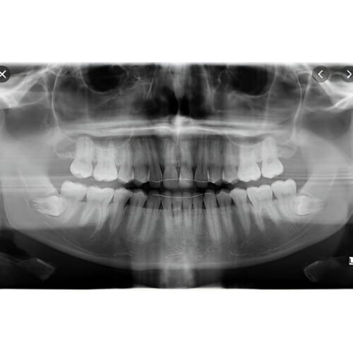 Instrumentarium OP300 Pan + CBCT