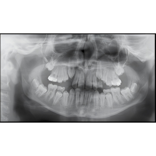 Instrumentarium OP300 Pan + CBCT