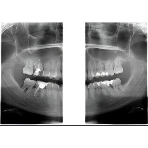 Instrumentarium OP300 Pan + CBCT