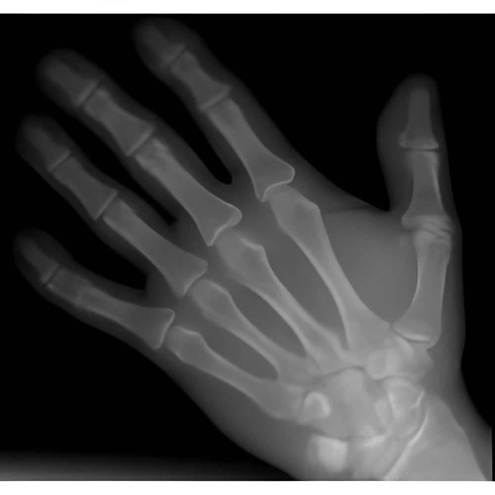 Instrumentarium OP300 Maxio Pan + CBCT (8x15 FOV)