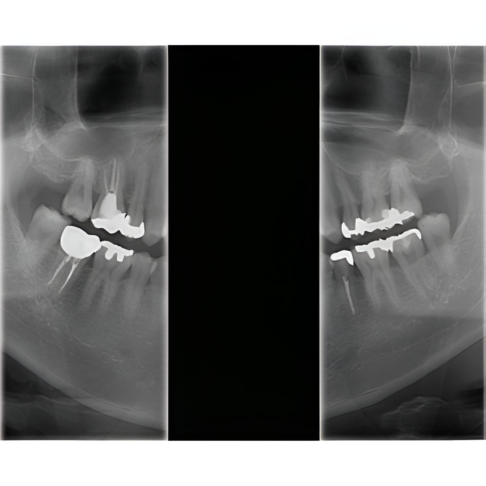 J. Morita Veraviewepocs X-800 Pan + CBCT (10x8 FOV)