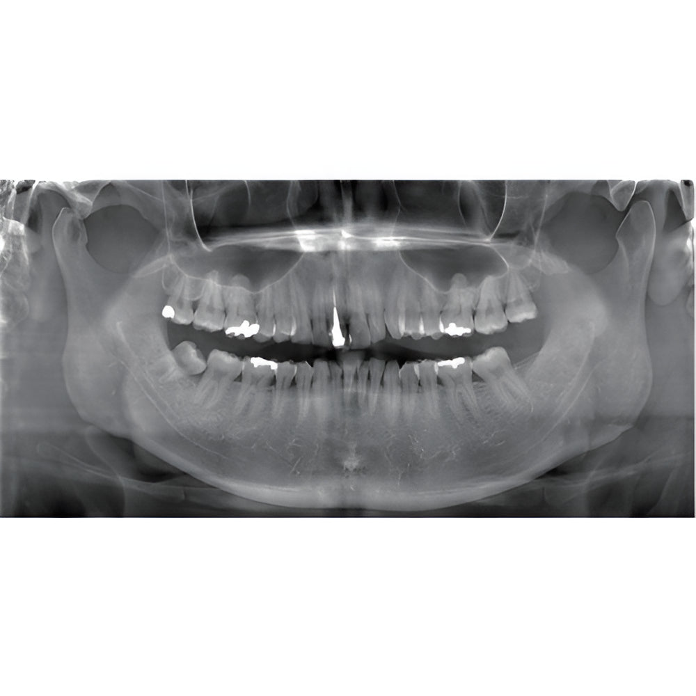 J. Morita Veraviewepocs X-800 Pan + CBCT (10x8 FOV)