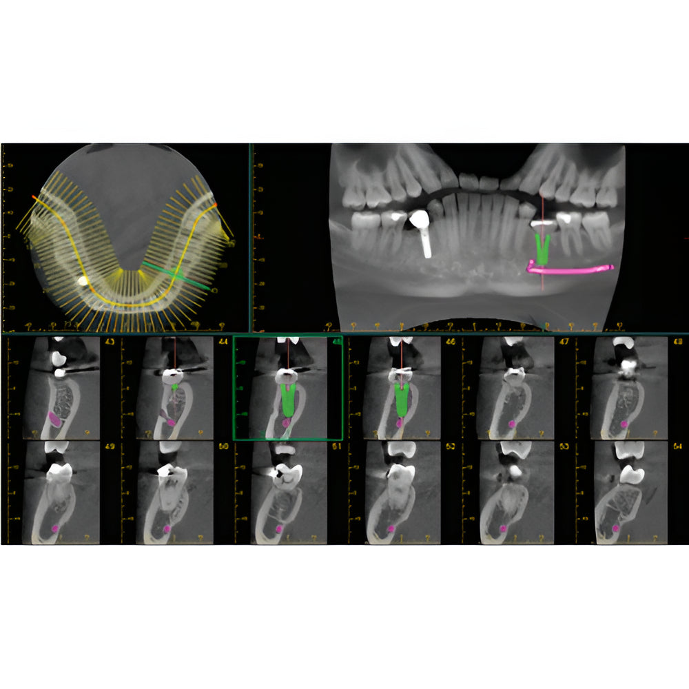 J. Morita Veraviewepocs X-800 Pan + CBCT (10x8 FOV)