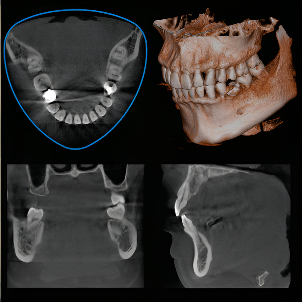 J. Morita Veraviewepocs X-800 Pan + CBCT (10x8 FOV)