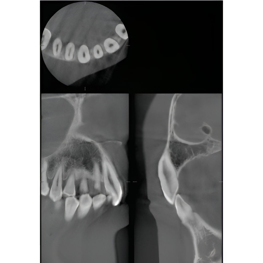 J. Morita Veraviewepocs X-800 Pan + CBCT (10x8 FOV)