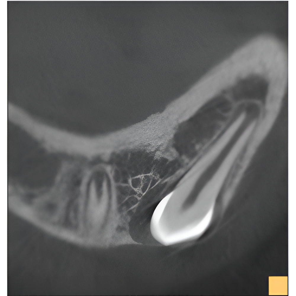J. Morita Veraviewepocs X-800 Pan + CBCT (10x8 FOV)
