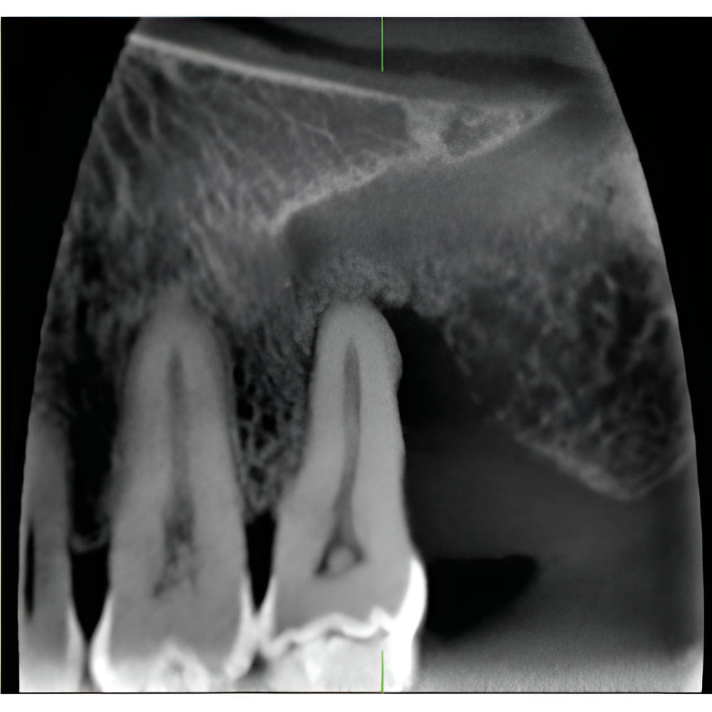J. Morita Veraviewepocs X-800 Pan + CBCT (10x8 FOV)