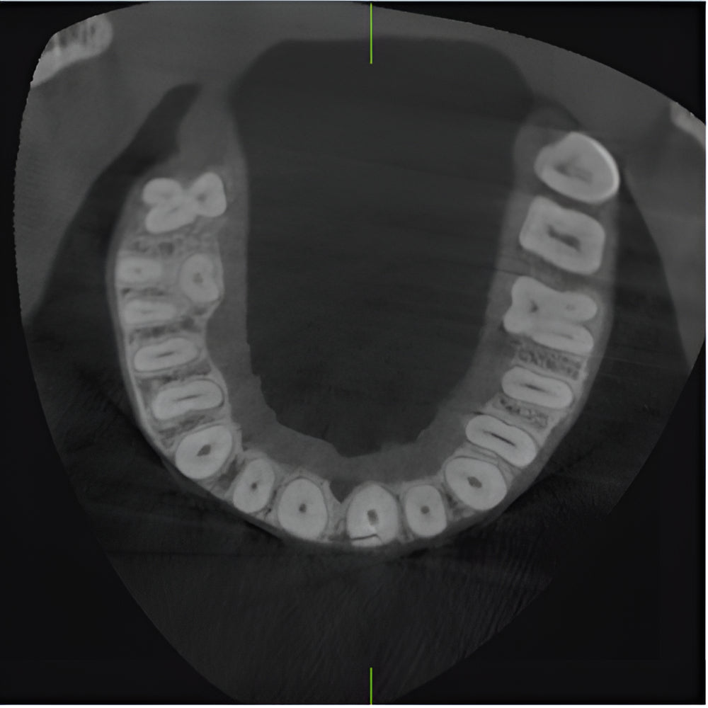 J. Morita Veraviewepocs X-800 Pan + CBCT (10x8 FOV)