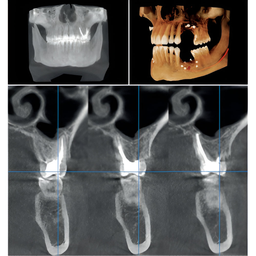 KaVo OP3D Pan + CBCT (FOV 9x11)