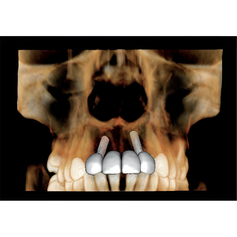 KaVo OP3D Pan + CBCT (FOV 9x11)