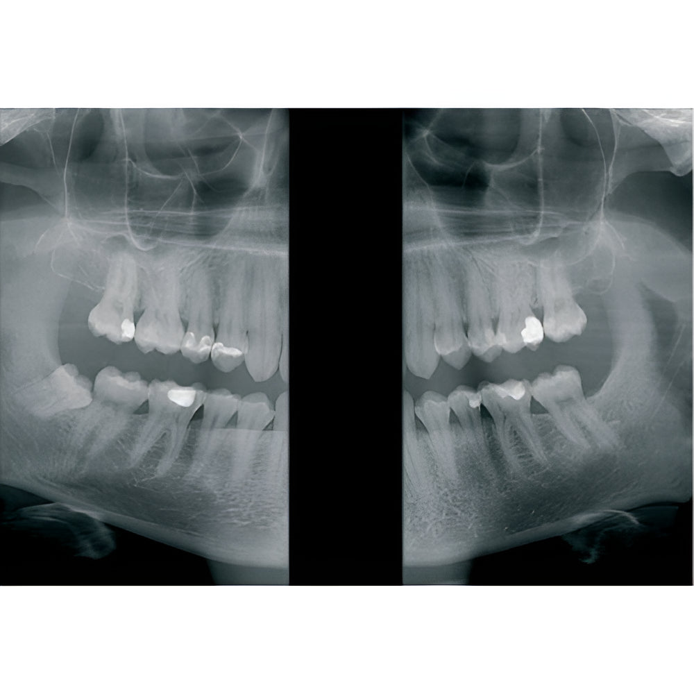 KaVo OP3D Pan + CBCT (FOV 9x11)