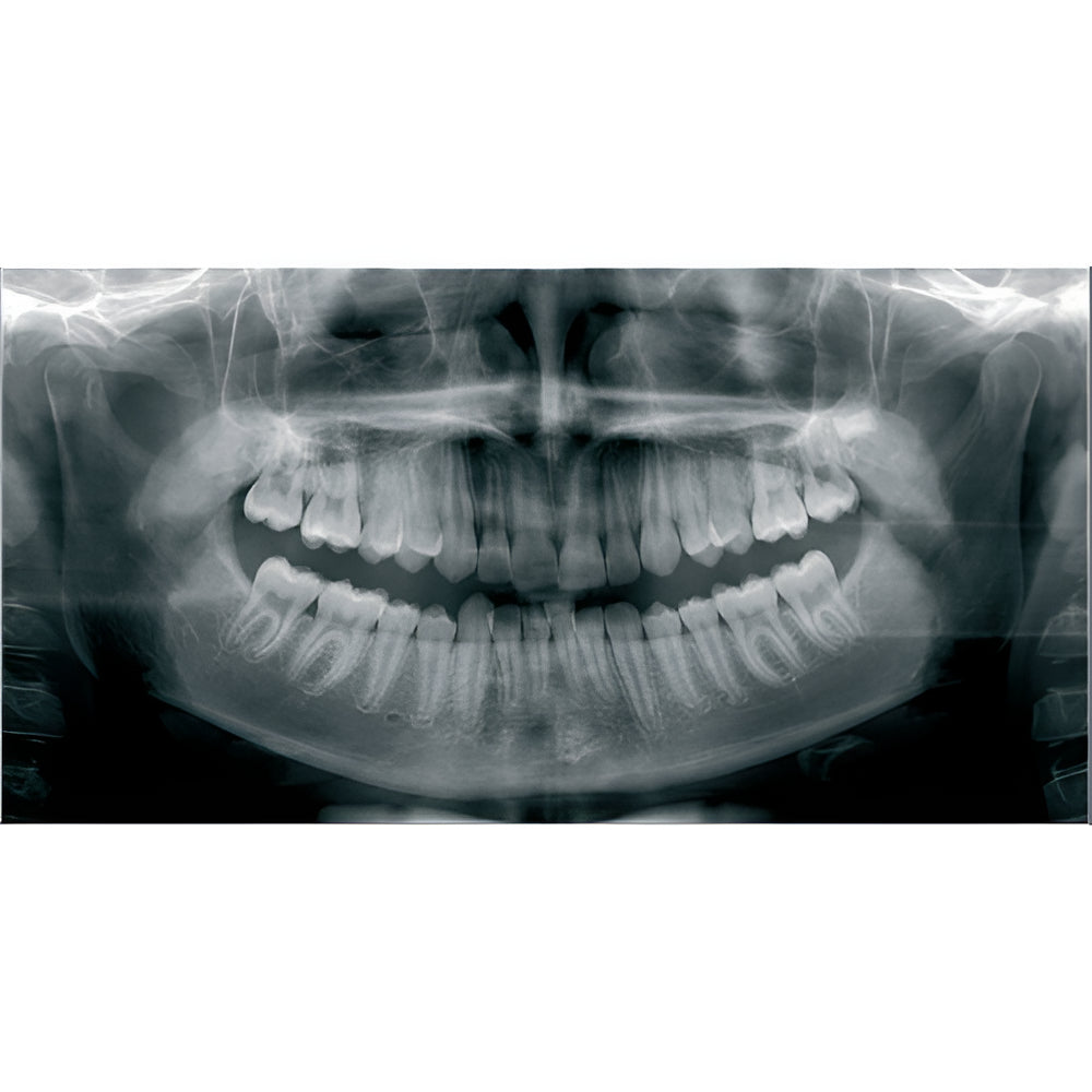 KaVo OP3D Pan + CBCT (FOV 9x11)