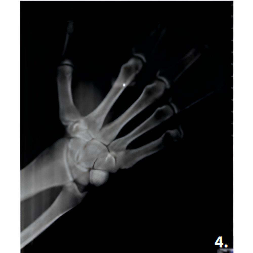 MyRay Hyperion X9 PRO Pan + Ceph + CBCT (13x16 FOV)