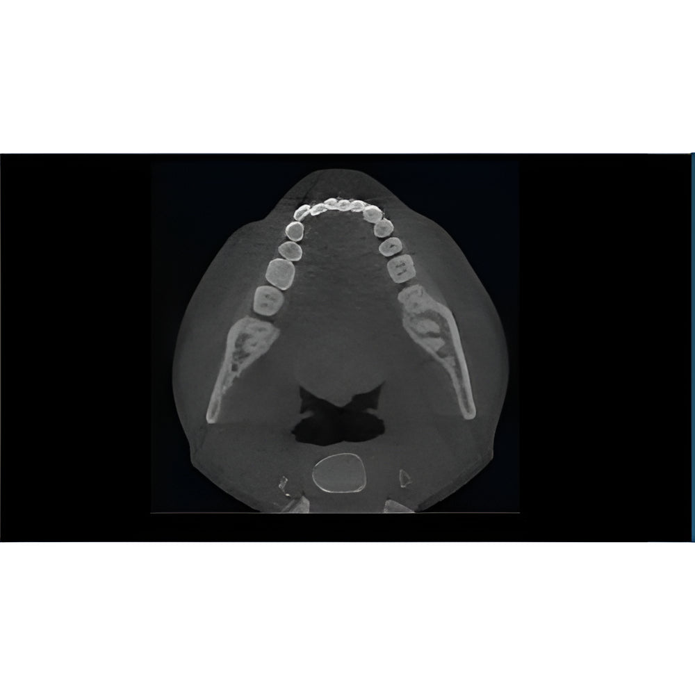 NewTom VGi Pan + CBCT (15x15 FOV)