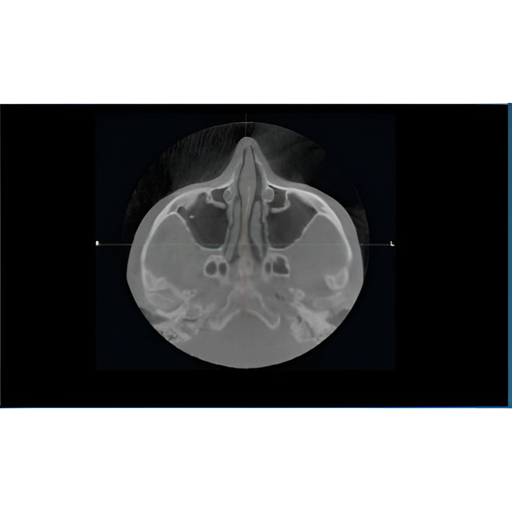 NewTom VGi Pan + CBCT (15x15 FOV)