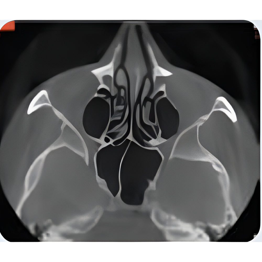 NewTom VGi Pan + CBCT (15x15 FOV)