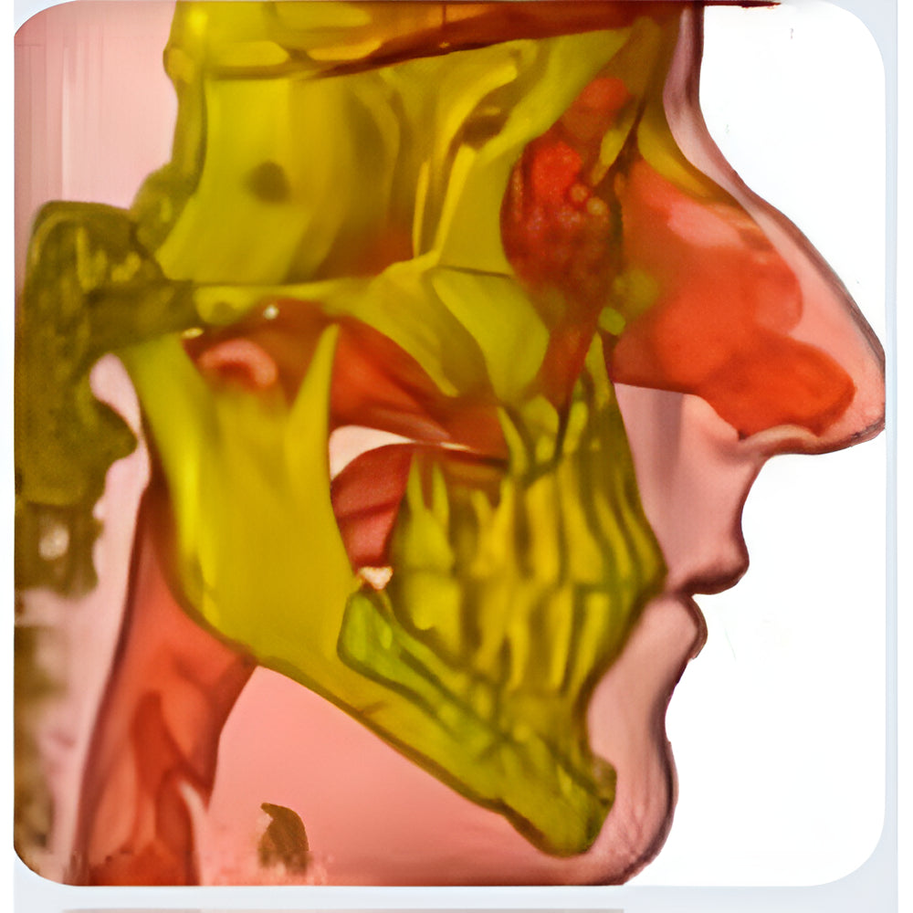 NewTom VGi Pan + CBCT (15x15 FOV)