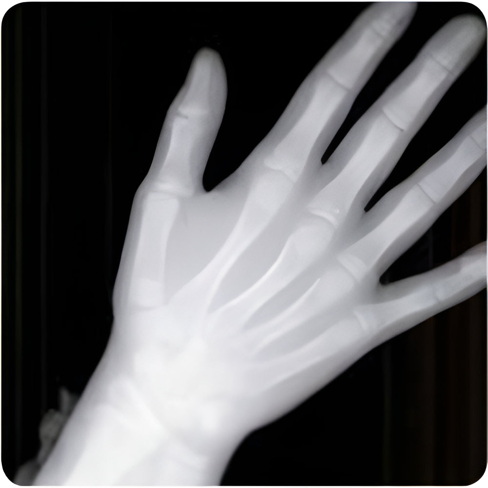NewTom Giano Pan + Ceph + CBCT (11x8 FOV)