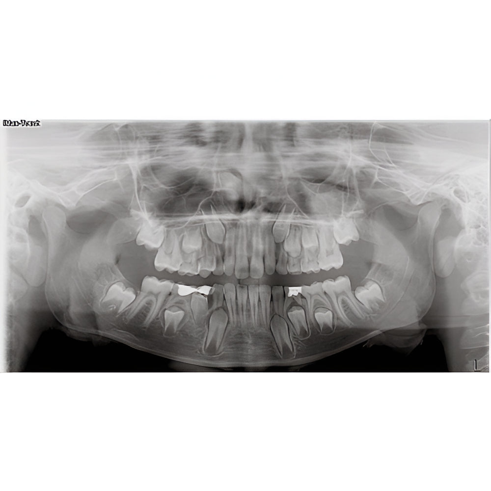 Owandy iMax Touch Pan + CBCT