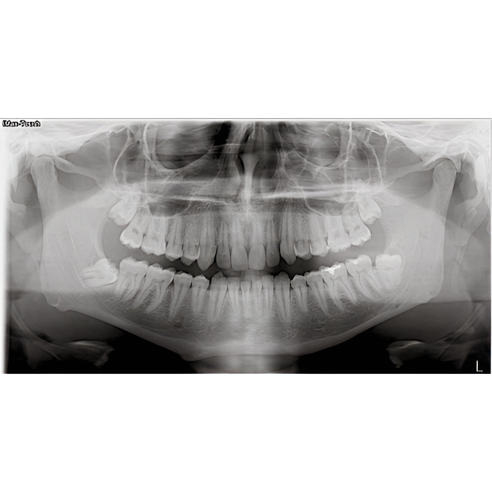 Owandy iMax Touch Pan + CBCT