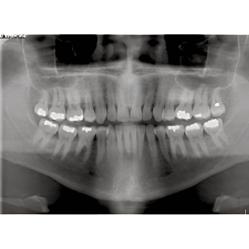 Owandy iMax Touch Pan + CBCT