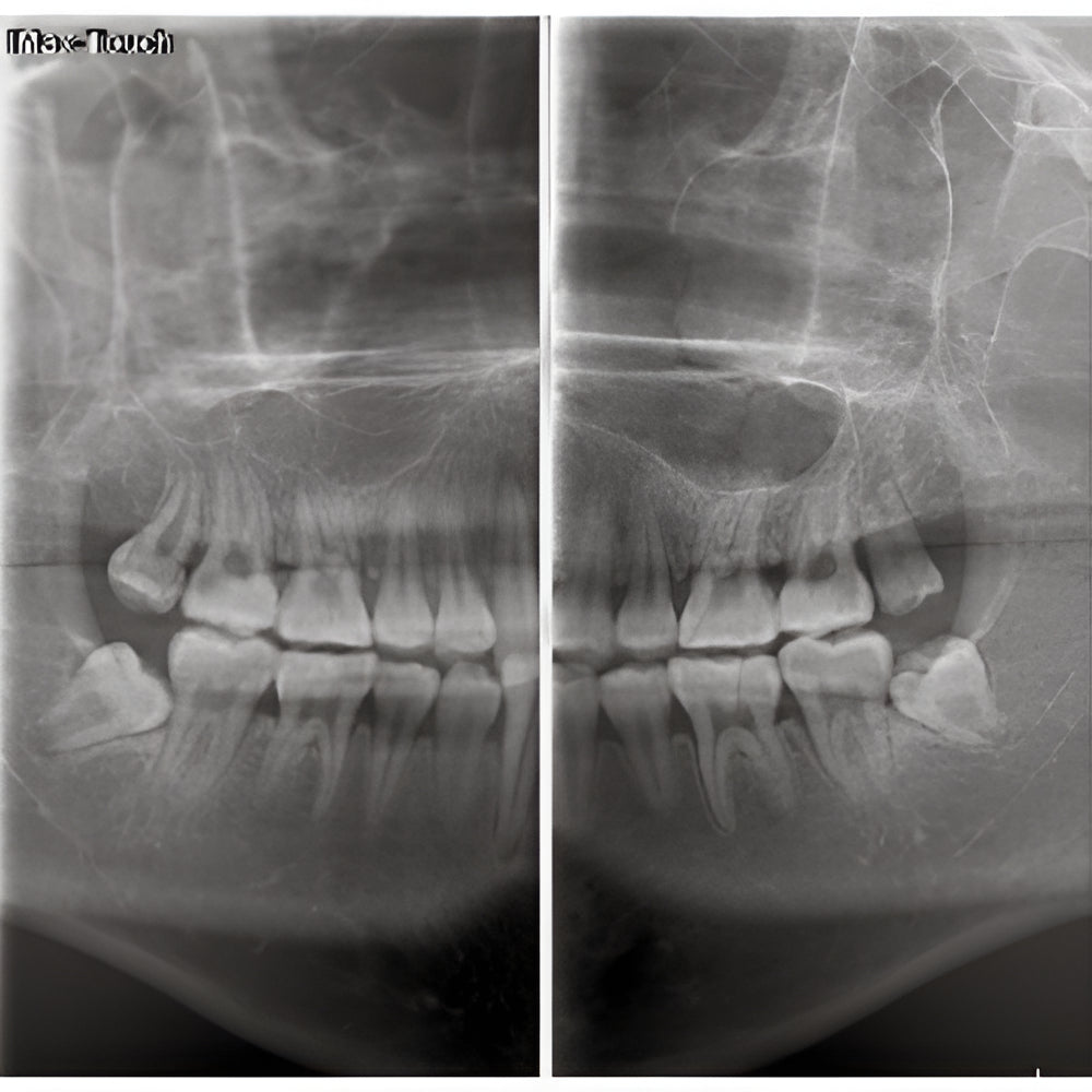 Owandy iMax Touch Pan + CBCT
