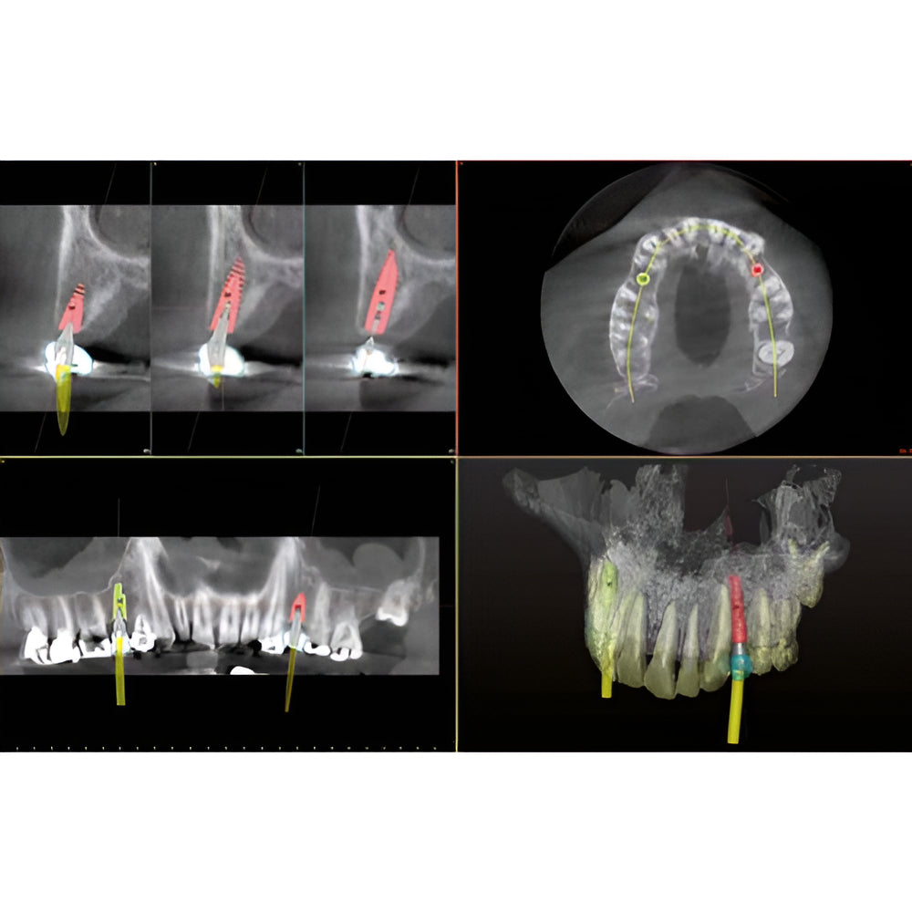 Owandy iMax Touch Pan + CBCT