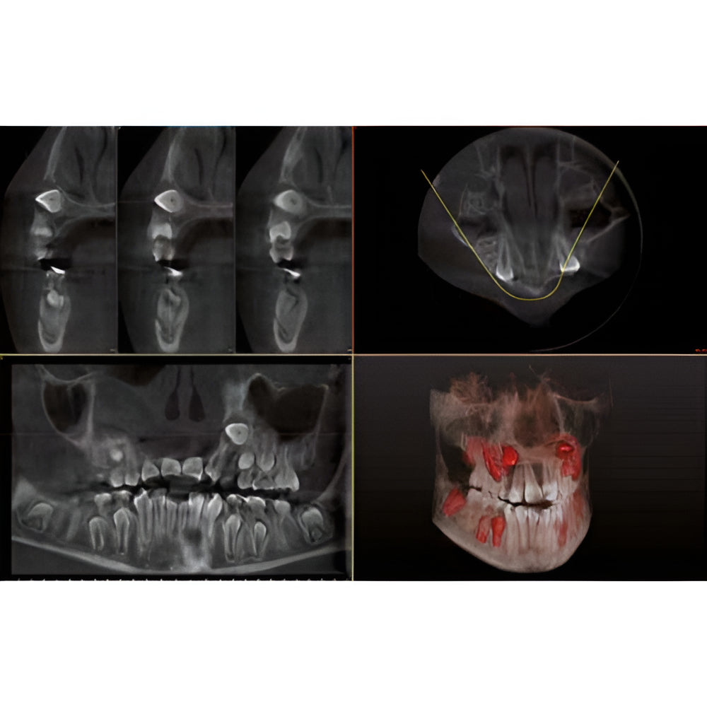 Owandy iMax Touch Pan + CBCT