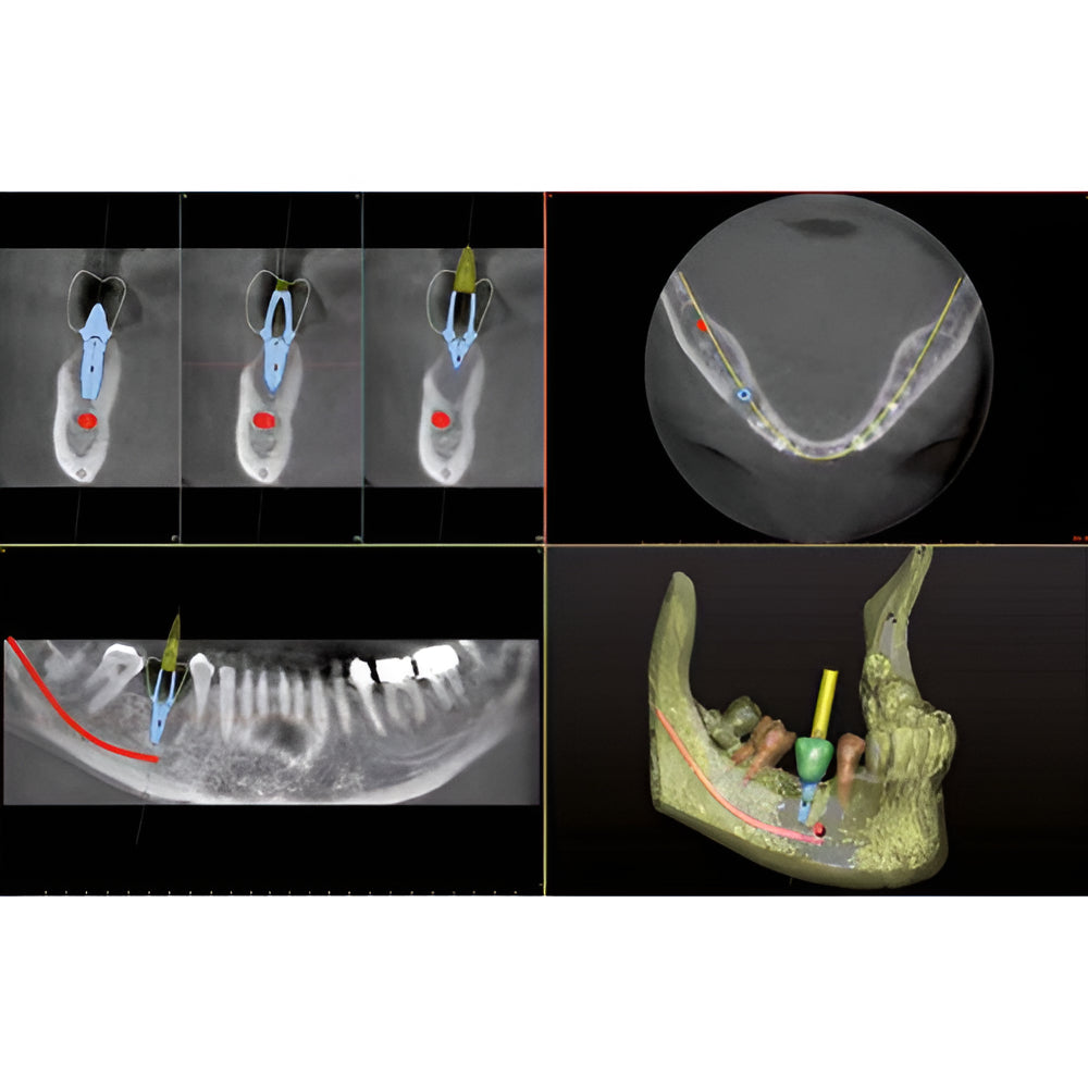 Owandy iMax Touch Pan + CBCT